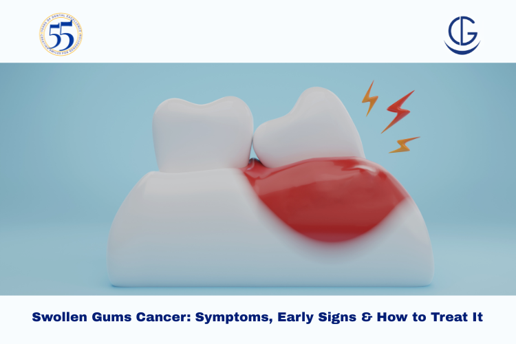 swollen gums cancer