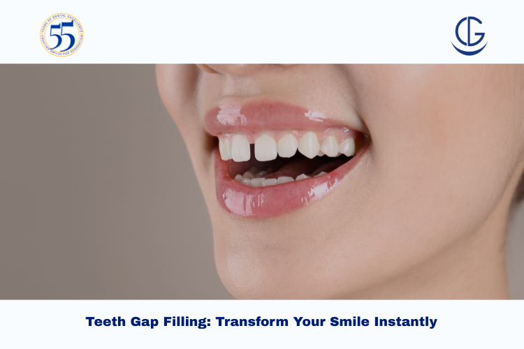teeth gap filling