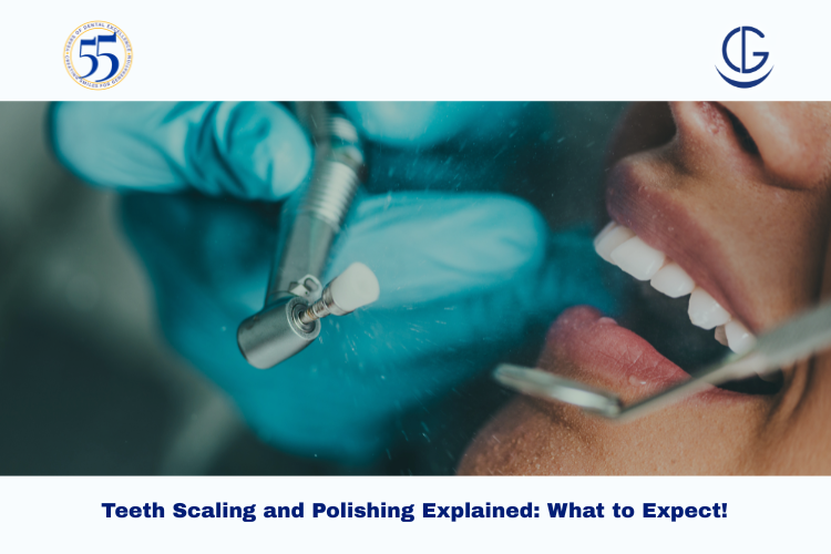 teeth scaling and polishing
