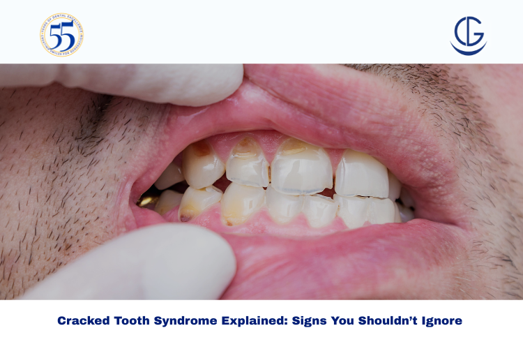 Cracked Tooth Syndrome