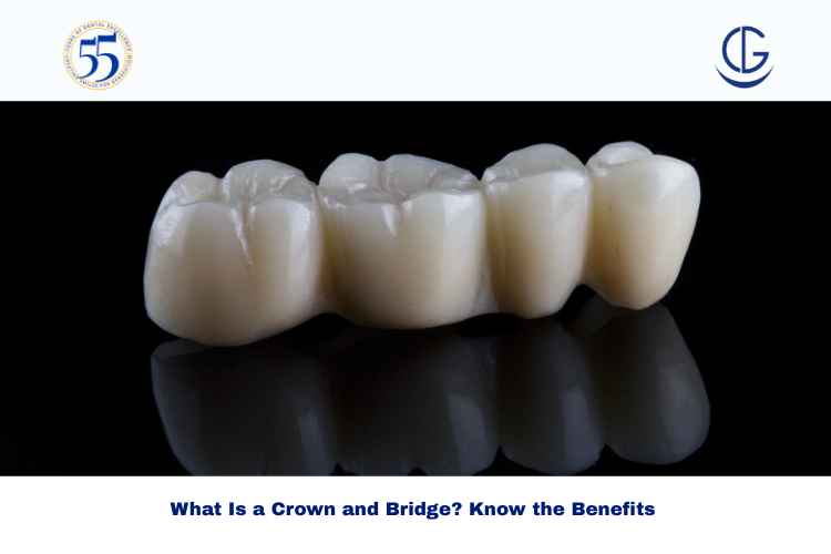 crown and bridge