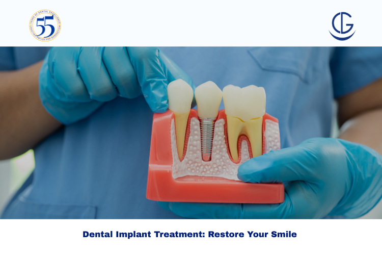 dental implant treatment
