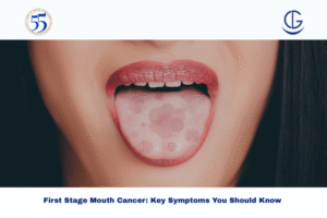 first stage mouth cancer