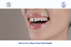 gap in front teeth