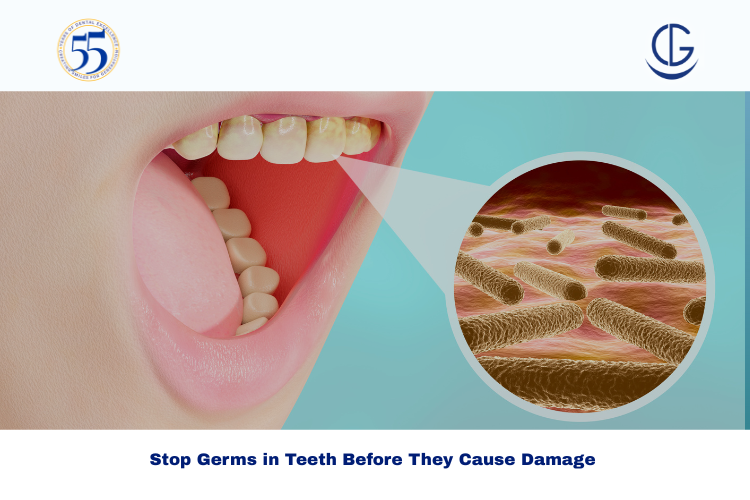 germs in teeth