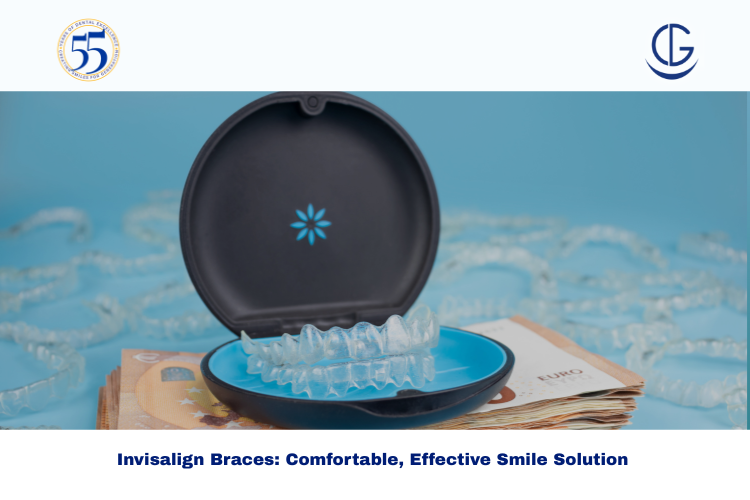 Invisalign Braces