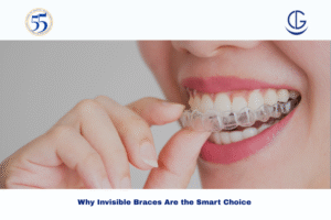 invisible braces