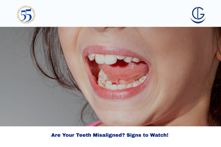 misaligned teeth