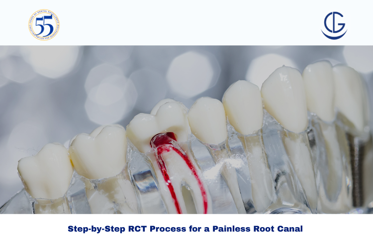 rct process