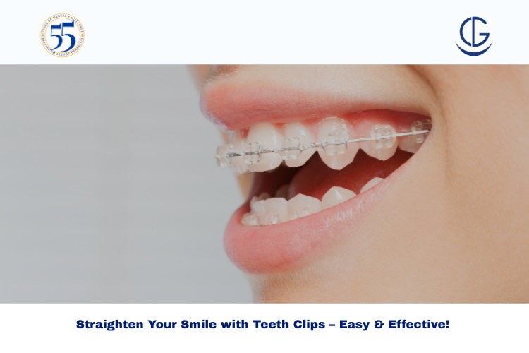 teeth clip