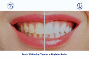 teeth whitening tips