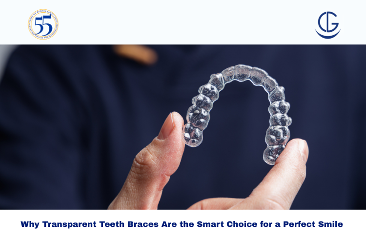 Transparent Teeth Braces