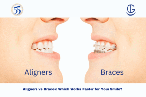aligners vs braces