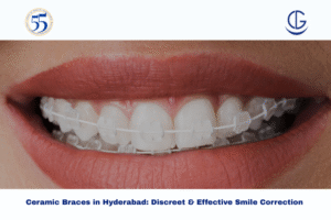 ceramic braces