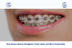 Damon Braces