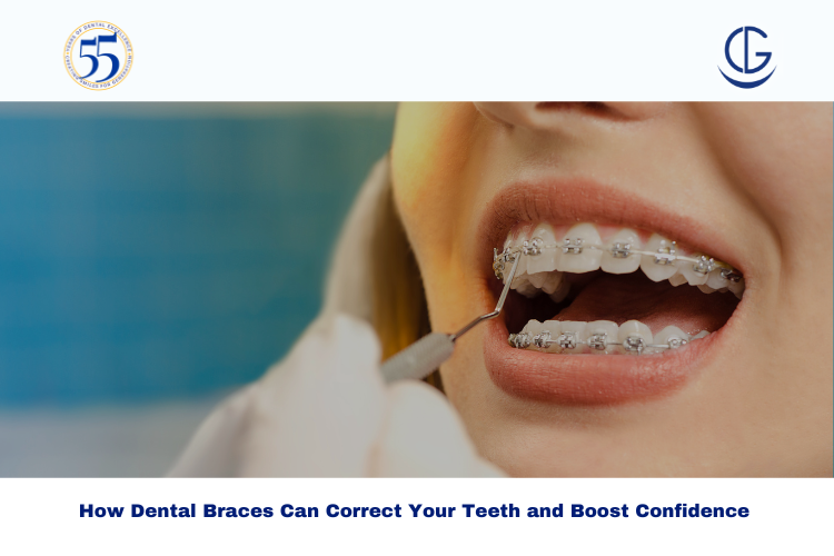 dental braces