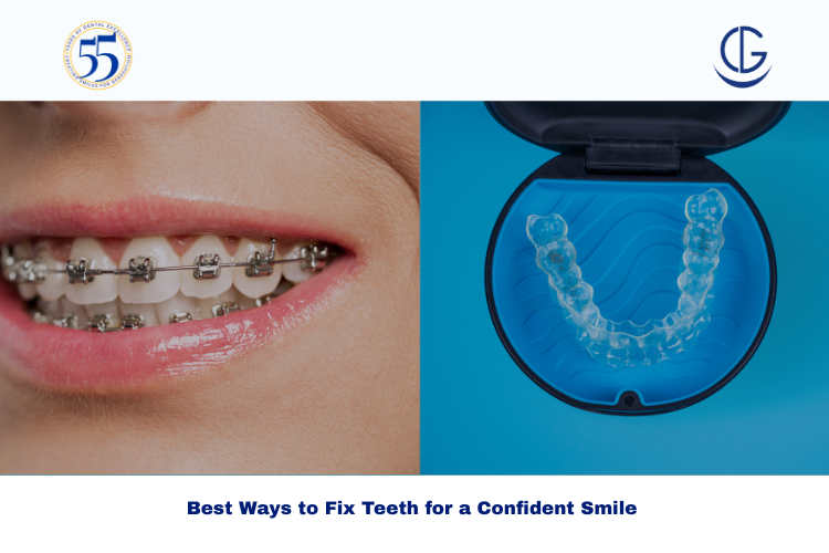 fix teeth