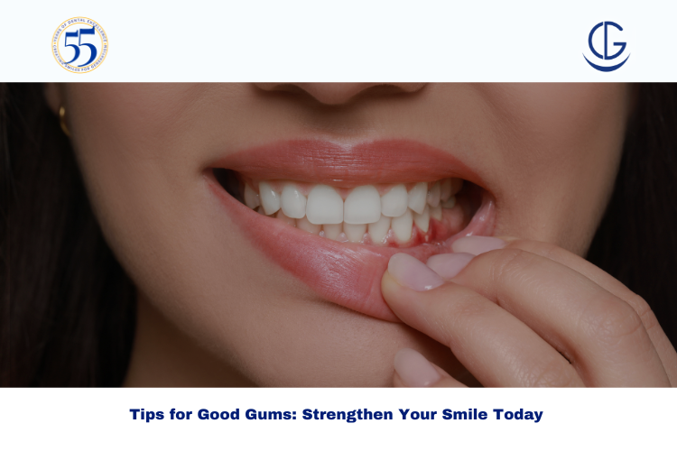 good gums