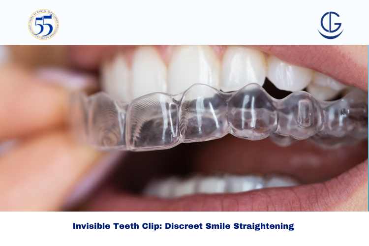 invisible teeth clip