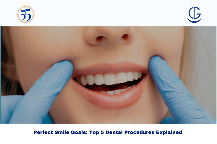 perfect smile