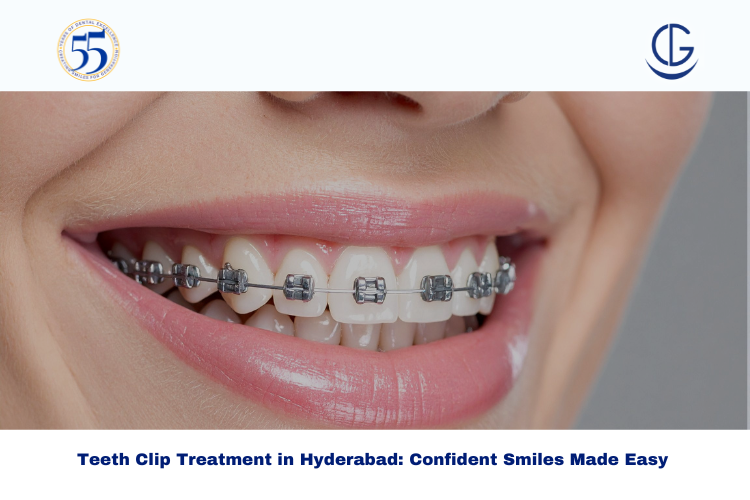 Teeth Clip Treatment