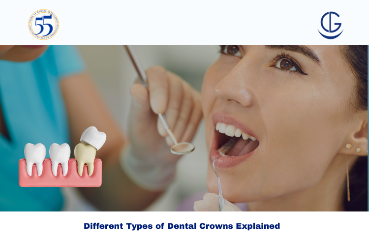 Types of Dental Crowns