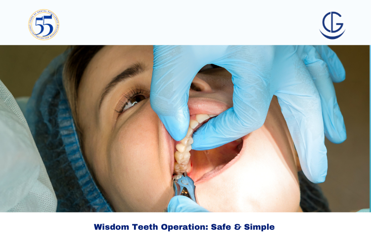 Wisdom Teeth Operation
