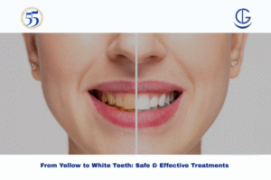 Yellow to White Teeth
