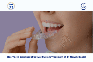 bruxism treatment