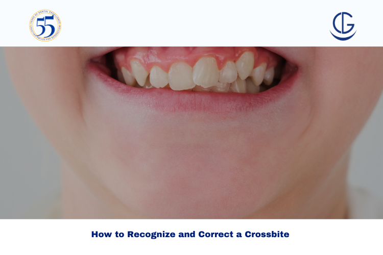 crossbite