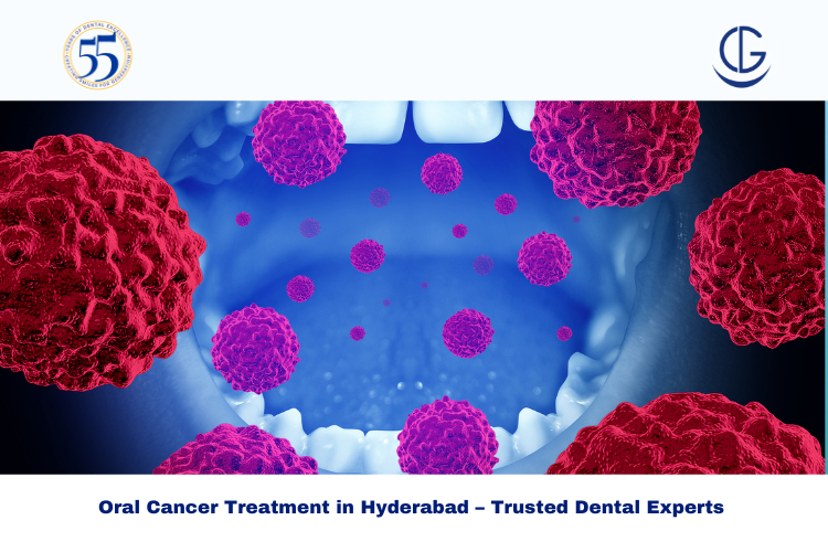 Oral cancer treatment