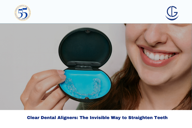 Clear dental aligners