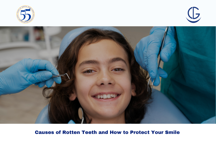 rotten teeth