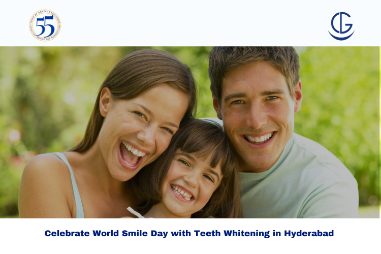 Teeth Whitening in Hyderabad