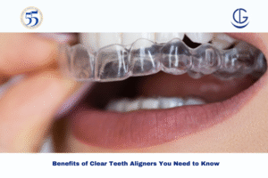 Clear Teeth Aligners