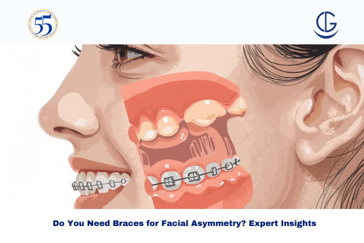 Braces for Facial Asymmetry