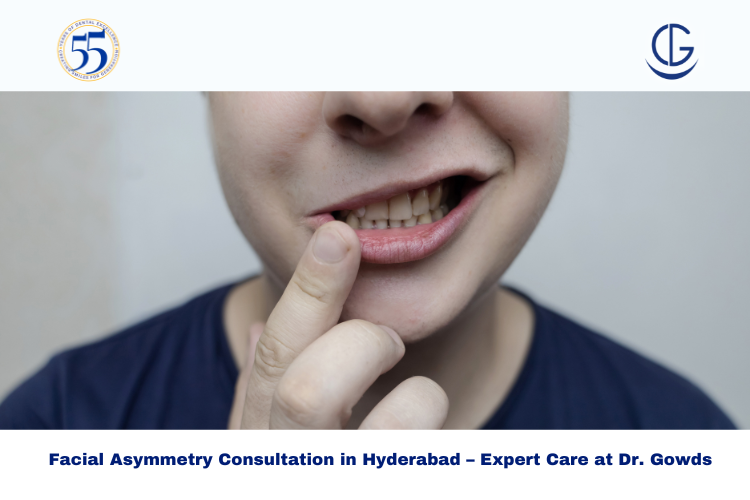facial asymmetry consultation