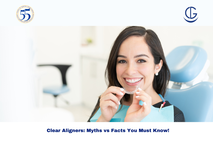 clear aligners