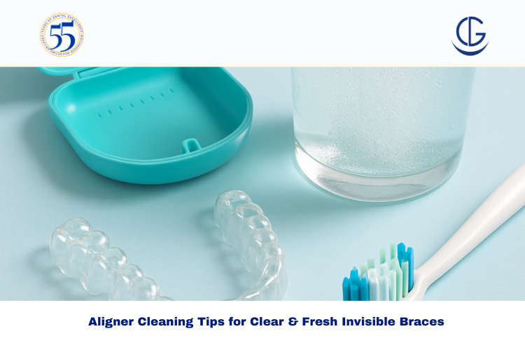 Aligner Cleaning