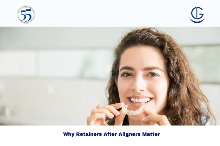 Retainers After Aligners