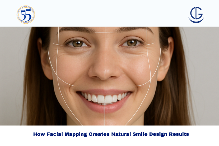 Smile Design Treatment