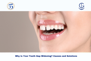 Teeth Gap Widening