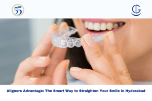 Aligners advantage
