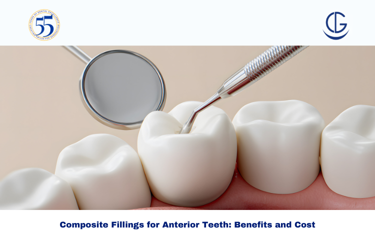 Composite Fillings for Anterior Teeth