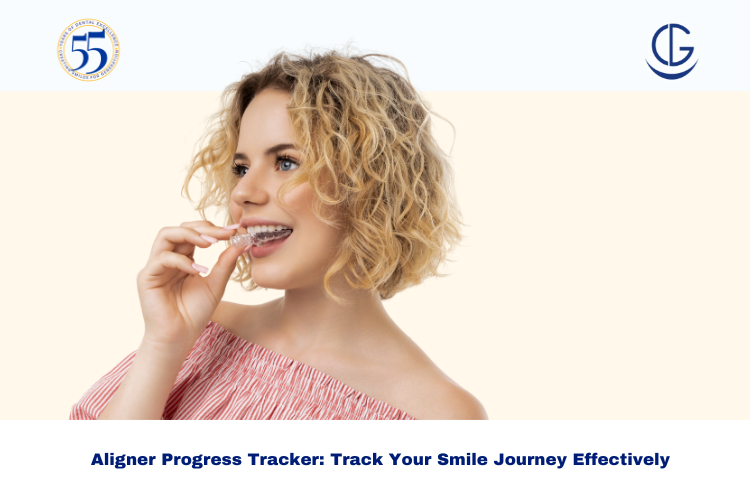 aligner progress tracker