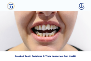 crooked teeth problems
