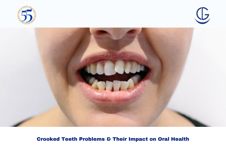 crooked teeth problems