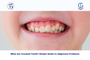 crooked tooth causes