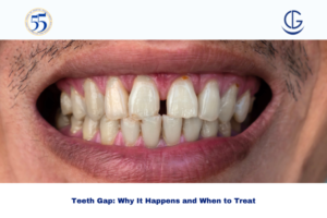 teeth gap