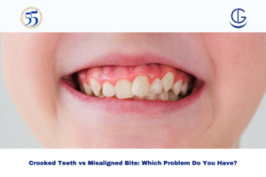 Crooked Teeth vs Misaligned Bite